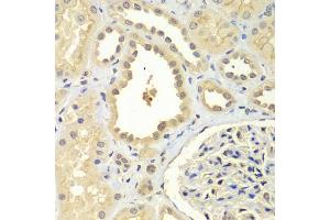 Immunohistochemistry of paraffin-embedded human kidney using ZNF346 antibody (ABIN5971759) at dilution of 1/100 (40x lens). (ZNF346 Antikörper)