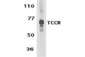 Western blot analysis of TCCR expression in human spleen tissue lysate with this product at 1 μg /ml. (IL27 Receptor alpha Antikörper  (C-Term))