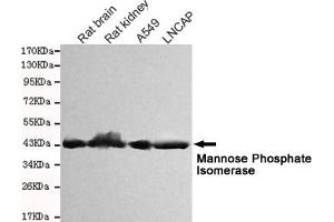 Western blot detection of Mannose Phosphate Isomerase in Rat kidney,Rat brain,A549 and Lncap cell lysates and using Mannose Phosphate Isomerase mouse mAb (1:1000 diluted). (MPI Antikörper)