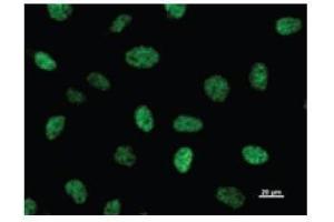 Immunostaining analysis in HeLa cells. (CBP Antikörper)