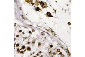 Immunohistochemical analysis of ASF1B staining in human testis formalin fixed paraffin embedded tissue section. (ASF1B Antikörper)