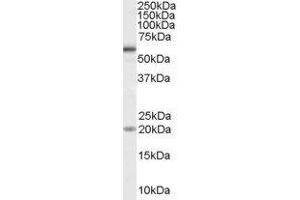 ABIN2561440 (1µg/ml) staining of HeLa cell lysate (35µg protein in RIPA buffer). (BMPR1A Antikörper  (Internal Region))