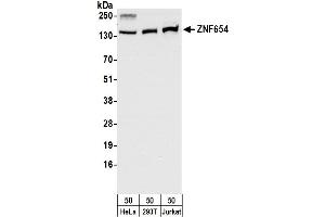 anti-Zinc Finger Protein 654 (ZNF654) (AA 477-527) antibody