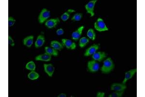 Immunofluorescence staining of A549 cells with ABIN7170348 at 1:200, counter-stained with DAPI. (SNX12 Antikörper  (AA 2-172))