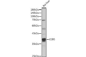 Western blot analysis of extracts of Rat liver, using CCR5 antibody (ABIN7266307) at 1:1000 dilution. (CCR5 Antikörper  (AA 100-200))