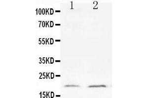 Anti-Bcl-XS antibody, Western blotting All lanes: Anti Bcl-XS  at 0.