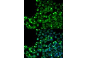 Immunofluorescence analysis of U20S cell using MGMT antibody. (MGMT Antikörper  (AA 1-207))