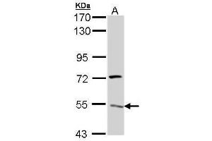 WB Image Sample (30 ug of whole cell lysate) A: Hela 7. (ATP6V1H Antikörper  (Center))