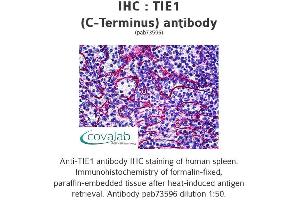 Image no. 1 for anti-tyrosine Kinase with Immunoglobulin-Like and EGF-Like Domains 1 (TIE1) (C-Term) antibody (ABIN1740068) (TIE1 Antikörper  (C-Term))