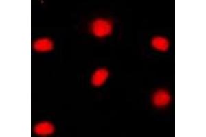 Immunofluorescent analysis of RB1 (pS795) staining in WERI cells.