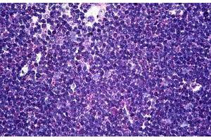 Human Thymus: Formalin-Fixed, Paraffin-Embedded (FFPE) (CD58 Antikörper  (AA 1-241))