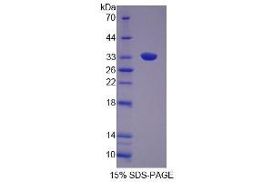 SDS-PAGE analysis of Rat GRB14 Protein. (GRB14 Protein)