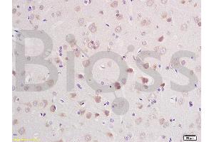 Formalin-fixed and paraffin embedded rat brain labeled with Anti-CLCN3 Polyclonal Antibody, Unconjugated (ABIN1386131) at 1:200 followed by conjugation to the secondary antibody and DAB staining