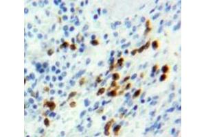 Used in DAB staining on fromalin fixed paraffin-embedded Spleen tissue (Retinoblastoma 1 Antikörper  (AA 639-778))