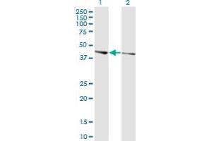 Western Blot analysis of PHACTR3 expression in transfected 293T cell line by PHACTR3 monoclonal antibody (M02), clone 4A5. (PHACTR3 Antikörper  (AA 92-179))