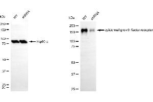 Western blotting analysis using epidermal growth factor receptor antibody (ABIN7798473).