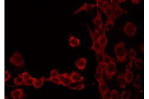 ABIN6268754 staining HeLa by IF/ICC. (TOMM20 Antikörper  (Internal Region))