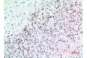 Immunohistochemistry (IHC) analysis of paraffin-embedded Human Brain, antibody was diluted at 1:100. (P57 (Ser24) Antikörper)