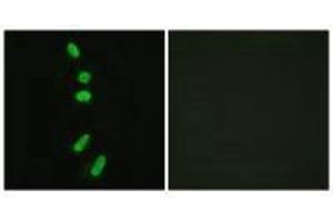 Immunofluorescence analysis of HeLa cells, using SF1 (Ab-82) antibody. (Splicing Factor 1 Antikörper  (Ser82))