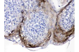 Elafin/Skalp was detected in paraffin-embedded sections of human tonsil tissues using rabbit anti- Elafin/Skalp Antigen Affinity purified polyclonal antibody (Catalog # ) at 1 µg/mL. (PI3 Antikörper  (AA 61-117))