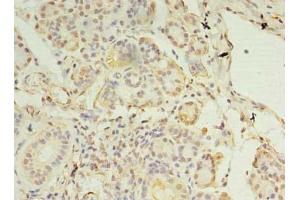 Immunohistochemistry of paraffin-embedded human pancreatic tissue using ABIN7146318 at dilution of 1:100 (CCDC109B Antikörper  (Regulatory Subunit))