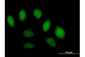 Immunofluorescence of purified MaxPab antibody to SFMBT1 on HeLa cell.