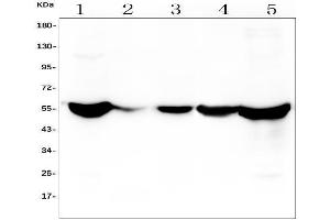 Western blot analysis of ALDH2 using anti-ALDH2 antibody (ABIN7603107).