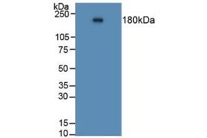 Figure. (Angiotensin I Converting Enzyme 1 Antikörper  (AA 814-1071))