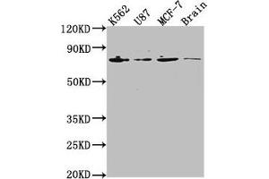 Western Blot Positive WB detected in: K562 whole cell lysate, U87 whole cell lysate, MCF-7 whole cell lysate, Rat brain tissue All lanes: LMNA antibody at 1:2000 Secondary Goat polyclonal to rabbit IgG at 1/50000 dilution Predicted band size: 75, 66, 71, 64, 63, 70 kDa Observed band size: 75 kDa (Lamin A/C Antikörper  (AA 385-572))