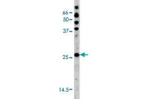 The CDKN1B (phospho S178) polyclonal antibody  is used in Western blot to detect Phospho-CDKN1B-S178 in HL-60 tissue lysate