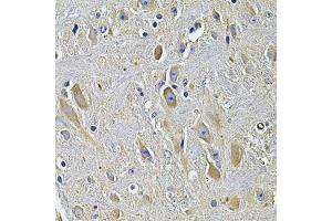 Immunohistochemistry of paraffin-embedded rat brain using PLCG1 Antibody. (Phospholipase C gamma 1 Antikörper)