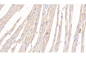 Detection of KNT1 in Rat Heart Tissue using Monoclonal Antibody to T-Kininogen 1 (KNT1) (KNG1 Antikörper  (AA 378-430))