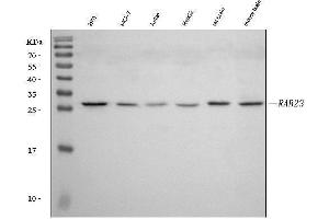 Western blot analysis of RAB23 using anti-RAB23 antibody (ABIN7600675).