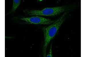 Indirect immunostaining of HELA cells (dilution 1 : 100; green).
