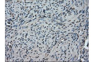 Immunohistochemical staining of paraffin-embedded Ovary tissue using anti-TMEM100mouse monoclonal antibody. (TMEM100 Antikörper)