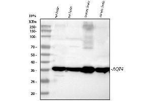Western blot analysis of Aquaporin 4 using anti-Aquaporin 4 antibody (ABIN3043789).