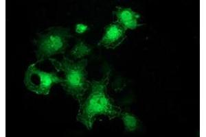 Anti-FHL1 mouse monoclonal antibody (ABIN2453832) immunofluorescent staining of COS7 cells transiently transfected by pCMV6-ENTRY FHL1 (RC203478). (FHL1 Antikörper)