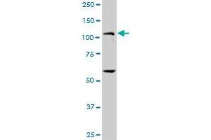 PKN1 MaxPab rabbit polyclonal antibody. (PKN1 Antikörper  (AA 1-942))
