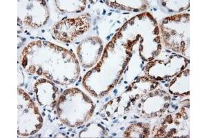 Immunohistochemical staining of paraffin-embedded Kidney tissue using anti-PLEK mouse monoclonal antibody. (Pleckstrin Antikörper)