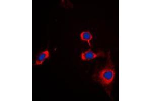 Immunofluorescent analysis of CD172a staining in THP1 cells. (SIRPA Antikörper  (C-Term))