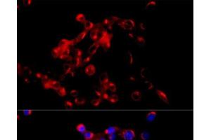 Immunofluorescence analysis of NIH/3T3 cells using COPB2 Polyclonal Antibody at dilution of 1:100 (40x lens).