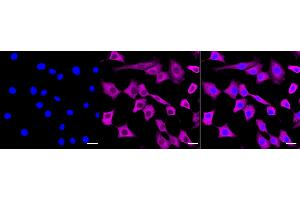 Immunocytochemical staining of C2C12 cells with Galectin 1 antibody (ABIN7799242), 1:1,000).