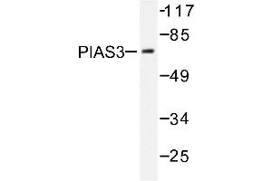 Image no. 1 for anti-Protein Inhibitor of Activated STAT, 3 (PIAS3) antibody (ABIN271953) (PIAS3 Antikörper)