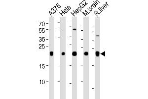 Western blot analysis of lysates from A375, Hela, HepG2 cell line, mouse brain and rat liver tissue lysate(from left to right), using ITPA Antibody at 1:1000 at each lane. (ITPA Antikörper  (N-Term))