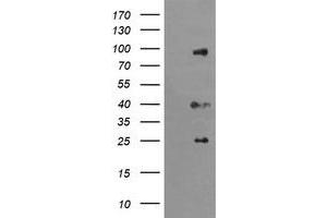 Image no. 1 for anti-Ubiquitin Specific Peptidase 16 (USP16) (AA 137-466) antibody (ABIN1490917) (USP16 Antikörper  (AA 137-466))