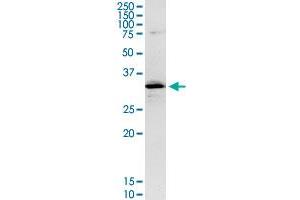 CENPH MaxPab rabbit polyclonal antibody. (CENPH Antikörper  (AA 1-247))