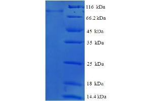 SDS-PAGE (SDS) image for Glucokinase (Hexokinase 4) Regulator (GCKR) (AA 1-625), (full length) protein (His-SUMO Tag) (ABIN5711309) (GCKR Protein (AA 1-625, full length) (His-SUMO Tag))