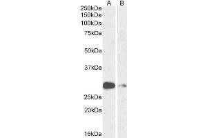 ABIN6391392 (1µg/ml) staining of Mouse (A) and Rat (B) Lung lysate (35µg protein in RIPA buffer). (ASCL1 Antikörper  (AA 79-91))