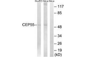 Western blot analysis of extracts from HeLa/HuvEc cells, using CEP55 Antibody. (CEP55 Antikörper  (AA 81-130))