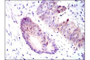 Immunohistochemistry (IHC) image for anti-Argininosuccinate Synthase 1 (ASS1) antibody (ABIN969503)